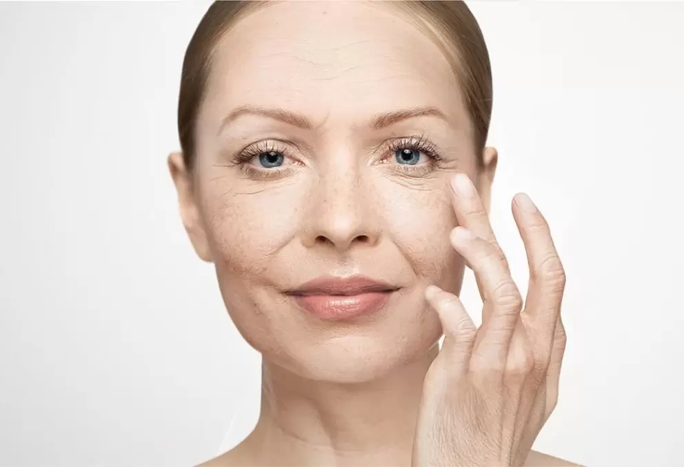 Les rides du visage et leur élimination avec la crème Eudalie